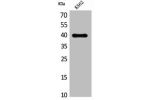 Western Blot analysis of K562 cells using CXCR-3 Polyclonal Antibody