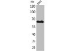 Western Blot analysis of K562 cells using Frizzled-10 Polyclonal Antibody