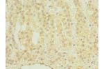 Immunohistochemistry of paraffin-embedded human adrenal gland tissue using CSB-PA005310LA01HU at dilution of 1:100