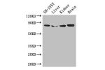 Western Blot<br />
Positive WB detected in:SH-SY5Y whole cell lysate,Mouse liver tissue,Mouse kidney tissue,Mouse brain tissue<br />
All lanes: CHAT antibody at 3ug/ml<br />
Secondary<br />
Goat polyclonal to rabbit IgG at 1/50000 dilution<br />
Predicted