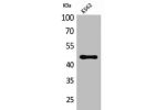 Western Blot analysis of K562 cells using CD177 Polyclonal Antibody
