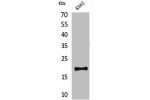 Western Blot analysis of K562 cells using CD160 Polyclonal Antibody