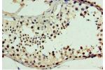 Immunohistochemistry of paraffin-embedded human testis using CSB-PA005327ESR1HU at dilution 1:100