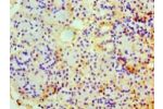 Immunohistochemistry of paraffin-embedded human pancreas tissue using CSB-PA005344YA01HU at dilution 1:100