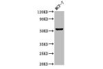 Western Blot<br />
Positive WB detected in:MCF-7 whole cell lysate<br />
All lanes:CHKA antibody at 3