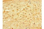 Immunohistochemistry of paraffin-embedded human placenta tissue using CSB-PA005356LA01HU at dilution of 1:100