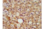 IHC image of CSB-PA005369LA01HU diluted at 1:800 and staining in paraffin-embedded human liver tissue performed on a Leica BondTM system. After dewaxing and hydration, antigen retrieval was mediated by high pressure in a citrate buffer (pH 6.0). Section w