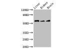 Western Blot<br />
Positive WB detected in:Mouse liver tissue,Mouse kidney tissue,Mouse brain tissue<br />
All lanes:CHRM5 antibody at 3.5