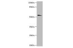 Western blot<br />
All lanes: Acetylcholine receptor subunit alpha antibody at 2ug/ml+Hela whole lysate<br />
Secondary<br />
Goat polyclonal to rabbit at 1/10000 dilution<br />
Predicted band size: 53kDa<br />
Observed band size: 53kDa<br />