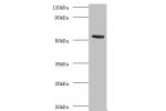 Western blot<br />
All lanes:Acetylcholine receptor subunit alpha antibody at 2ug/ml+recombinant Acetylcholine receptor subunit alpha protein 0.1ug<br />
Secondary<br />
Goat polyclonal to Rabbit IgG at 1/15000 dilution<br />
Predicted band size: 53kDa<br