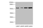 Western blot<br />
All lanes: CHRNE antibody at 1.87ug/ml<br />
Lane 1 : A549 whole cell lysate<br />
Lane 2 : Jurkat whole cell lysate<br />
Lane 3 : Hela whole cell lysate<br />
Lane 4 : HepG-2 whole cell lysate<br />
Secondary<br />
Goat polyclonal to 