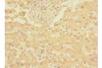 Immunohistochemistry of paraffin-embedded human liver tissue CSB-PA005400ESR2HU at dilution 1:100