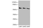 Western blot<br />
All lanes: CHRNG antibody at 5.5ug/ml<br />
Lane 1 : 293T whole cell lysate<br />
Lane 2 : HepG-2 whole cell lysate<br />
Lane 3 : Hela whole cell lysate<br />
Secondary<br />
Goat polyclonal to rabbit IgG at 1/10000 dilution<br />
Pred