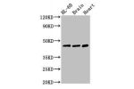 Western Blot<br />
Positive WB detected in:HL-60 whole cell lysate,Mouse brain tissue,Rat heart tissue<br />
All lanes:CHST1 antibody at 3