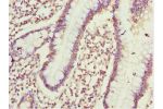 Immunohistochemistry of paraffin-embedded human small intestine tissue using CSB-PA005423ESR1HU at dilution 1:100