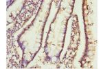 Immunohistochemistry of paraffin-embedded human small intestine tissue using CSB-PA005423ESR2HU at dilution 1:100