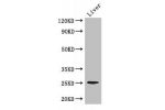 Western Blot<br />
Positive WB detected in:Mouse liver tissue<br />
All lanes: CIDEA antibody at 3.4ug/ml<br />
Secondary<br />
Goat polyclonal to rabbit IgG at 1/50000 dilution<br />
Predicted band size: 25 kDa<br />
Observed band size: 25 kDa<br />