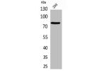 Western Blot analysis of 293 cells using Bcl-6 Polyclonal Antibody