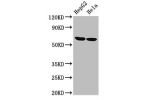Western Blot<br />
Positive WB detected in:HepG2 whole cell lysate,Hela whole cell lysate<br />
All lanes:CKAP4 antibody at 2.7