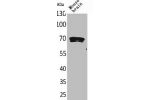 Western Blot analysis of mouse brain cells using Amphiphysin II Polyclonal Antibody