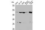 Western Blot analysis of A549 HT29 K562 mouse kidney mouse lung cells using GDI-2 Polyclonal Antibody