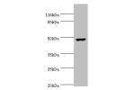Western blot<br />
All lanes:CKMT2 antibody at 6ug/ml+Hela whole cell lysate<br />
Secondary<br />
Goat polyclonal to rabbit at 1/10000 dilution<br />
Predicted band size: 48kDa<br />
Observed band size: 48kDa<br />