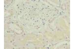 Immunohistochemistry of paraffin-embedded human kidney tissue using CSB-PA005468LA01HU at dilution of 1:100