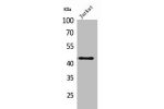 Western Blot analysis of Jurkat cells using E2F-4 Polyclonal Antibody