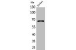 Western Blot analysis of Jurkat cells using ERa Polyclonal Antibody