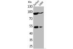 Western Blot analysis of Jurkat L929 cells using EPAS-1 Polyclonal Antibody