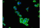 Immunofluorescent analysis of HepG2 cells using CSB-PA005481LA01HU at a dilution of 1:100 and Alexa Fluor 488-congugated AffiniPure Goat Anti-Rabbit IgG(H+L)