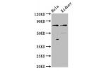 Western Blot<br />
Positive WB detected in:Hela whole cell lysate,Rat kidney tissue<br />
All lanes:CLCNKB antibody at 3