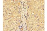 Immunohistochemistry of paraffin-embedded human liver tissue using CSB-PA005490LA01HU at dilution of 1:100