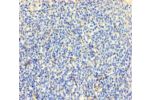 Immunohistochemistry of paraffin-embedded human tonsil tissue using CSB-PA005493LA01HU at dilution of 1:100