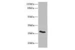 Western blot<br />
All lanes: CLDN18 antibody IgG at 5.02ug/ml+ Rat heart tissue<br />
Secondary<br />
Goat polyclonal to rabbit IgG at 1/10000 dilution<br />
Predicted band size: 28 kDa<br />
Observed band size: 28 kDa<br />