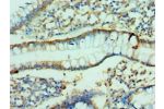 Immunohistochemistry of paraffin-embedded human small intestine using CSB-PA005500ESR2HU at dilution 1:100