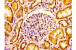 Immunohistochemistry of paraffin-embedded human kidney tissue using CSB-PA005508LA01HU at dilution of 1:100