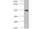 Western blot<br />
All lanes: C-type lectin domain family 18 member A antibody at 2ug/ml+mouse stomach tissue<br />
Secondary<br />
Goat polyclonal to Ribbit lgG at 1/10000 dilution<br />
Predicted band size: 50,12 kDa<br />
Observed band size: 50 kDa<br 