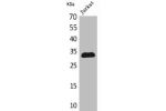 Western Blot analysis of Jurkat cells using p57 Polyclonal Antibody