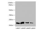 Western blot<br />
All lanes: CLEC3A antibody at 0.4ug/ml<br />
Lane 1 : Mouse liver tissue<br />
Lane 2 : Mouse kidney tissue<br />
Lane 3 : Mouse brain tissue<br />
Lane 4 : Mouse lung tissue<br />
Secondary<br />
Goat polyclonal to Rabbit IgG at 1/1000