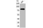 Western Blot analysis of 293 cells using Btk Polyclonal Antibody.