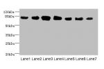 Western blot<br />
All lanes:CLGN antibody at 7ug/ml<br />
Lane 1: Mouse brain tissue<br />
Lane 2: Mouse lung tissue<br />
Lane 3: Jurkat whole cell lysate<br />
Lane 4:HepG-2 whole cell lysate<br />
Lane 5:PC-3 whole cell lysate<br />
Lane 6:Hela whole 