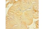 Immunohistochemistry of paraffin-embedded human skeletal muscle tissue using CSB-PA005547LA01HU at dilution 1:100