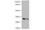 All lanes:Chloride intracellular channel protein 4 antibody at 5ug/ml<br />
Lane 1:mouse kidney tissue<br />
Lane 2:mouse ovarian tissue<br />
Secondary<br />
Goat polyclonal to rabbit at 1/10000 dilution<br />
Predicted band size: 29kDa<br />
Observed ba