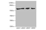 Western blot<br />
All lanes: