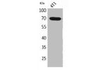 Western Blot analysis of 4T1 cells using Amphiphysin II Polyclonal Antibody.