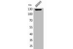 Western Blot analysis of AD293 cells using Arg Polyclonal Antibody.