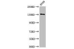 Western Blot<br />
Positive WB detected in:A549 whole cell lysate<br />
All lanes:EGFR antibody at 2.5
