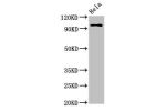 Western Blot<br />
Positive WB detected in:Hela whole cell lysate<br />
All lanes:CLOCK antibody at 3.5