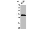 Western Blot analysis of AD293 cells using Bag-1 Polyclonal Antibody.